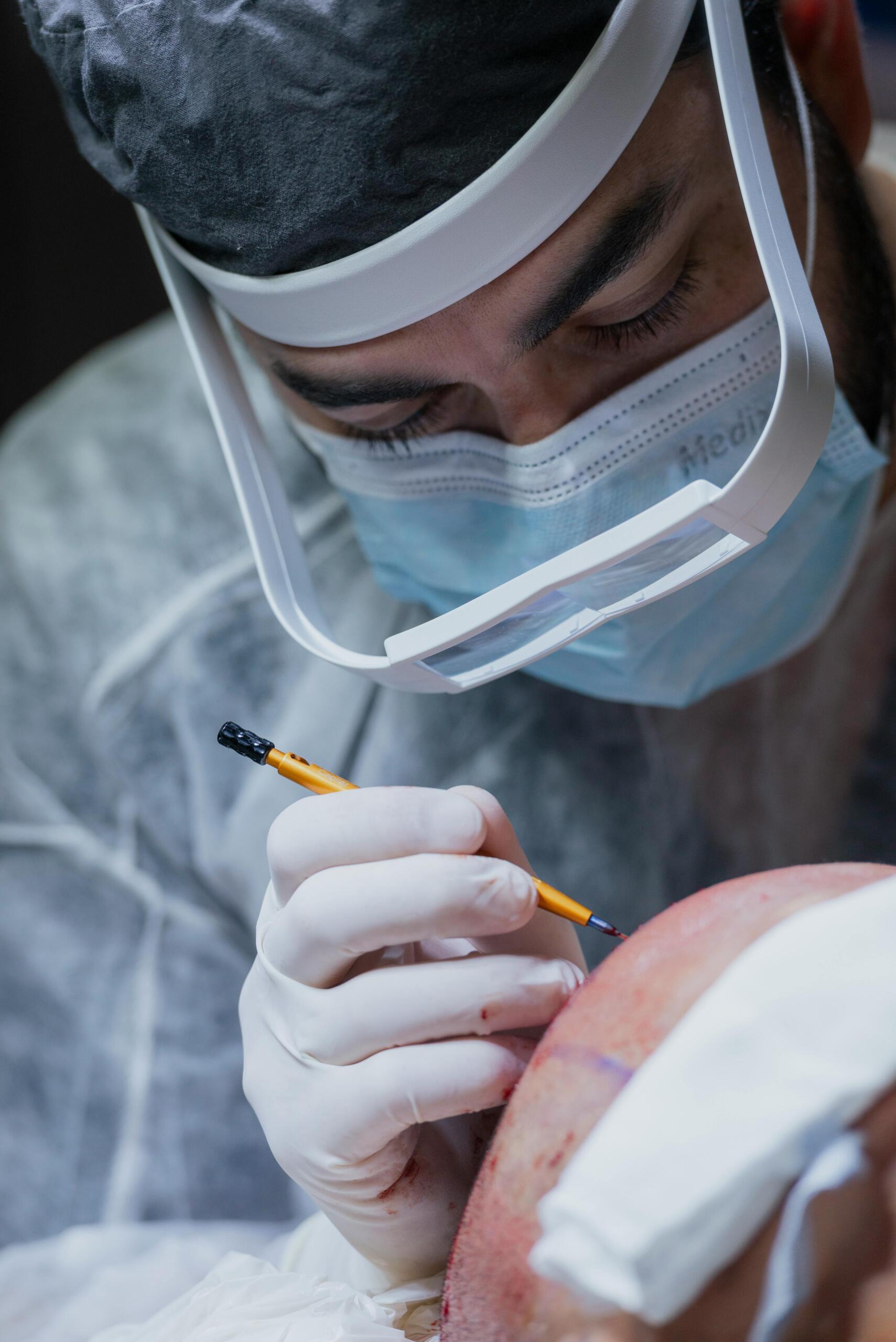 Scalp Micropigmentation